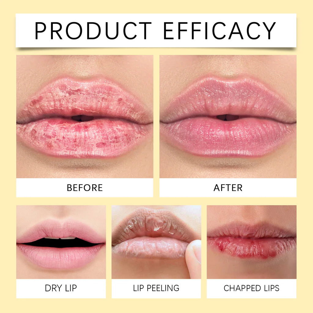 Vitamin C Remove Dark Lip Balm Lighten Melanin Lip Mask Exfoliating Fade Lip Lines Dead Skin Moisturize Brighten Repair Lip Care