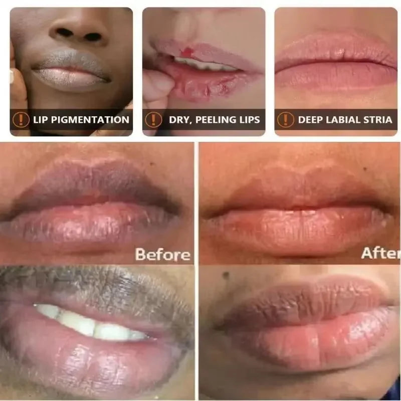 Vitamin C Remove Dark Lip Balm Lighten Melanin Lip Mask Exfoliating Fade Lip Lines Dead Skin Moisturize Brighten Repair Lip Care