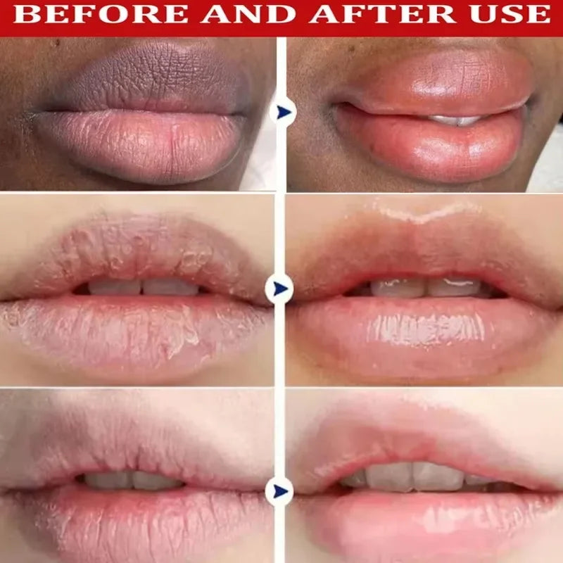 Vitamin C Remove Dark Lip Balm Lighten Melanin Lip Mask Exfoliating Fade Lip Lines Dead Skin Moisturize Brighten Repair Lip Care